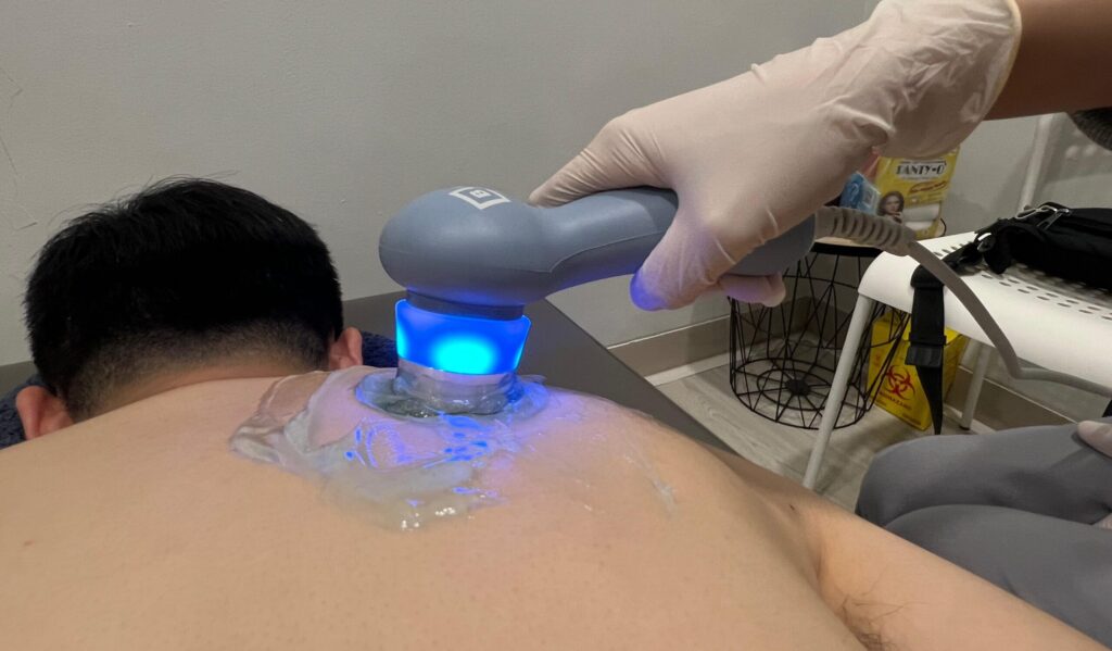 Fisioterapi Homecare