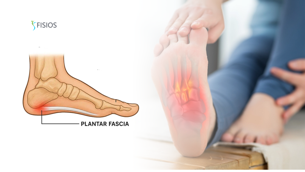 fisioterapi plantar fasciitis PIK