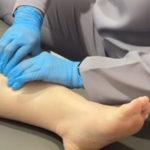 cara mencegah shin splint