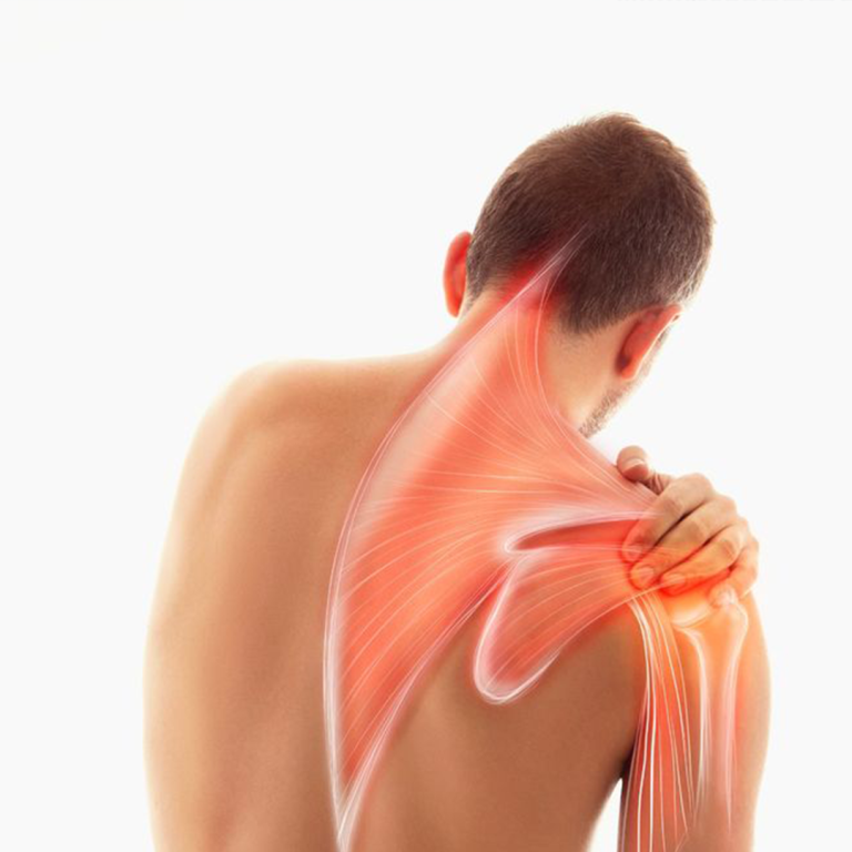 Fisioterapi Cedera Bahu